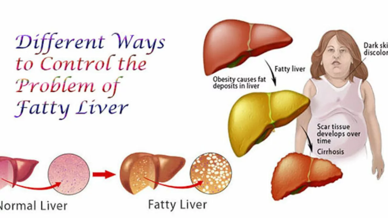 Guaifenesin and Liver Health: What You Should Know
